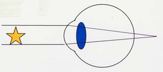 老視図